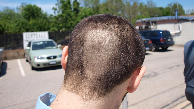 Illustration for article titled Ferrari Head Shave Gallery